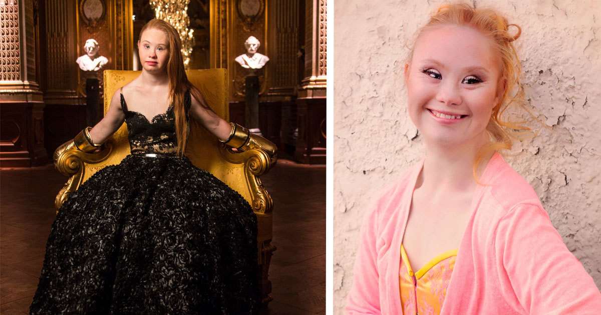 19 Year Old Madeleine Is The Worlds First Supermodel With Down Syndrome