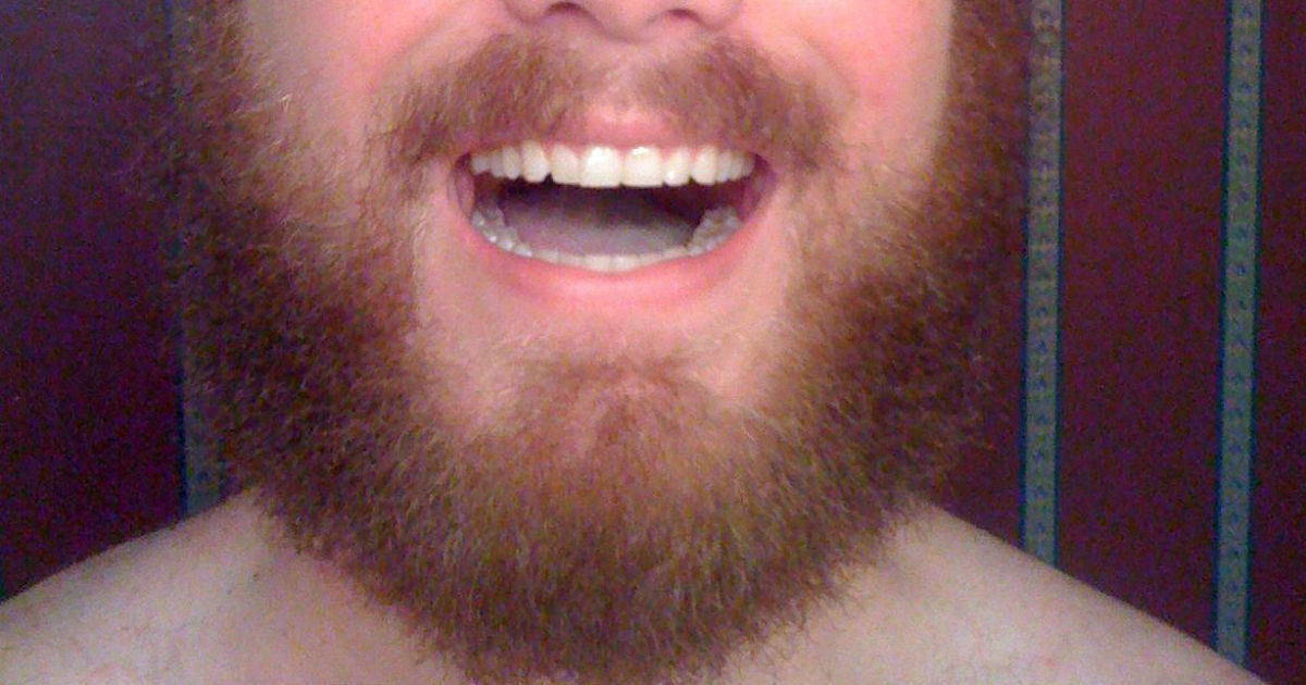 Scientist some beards contain more fecal bacteria than toilets