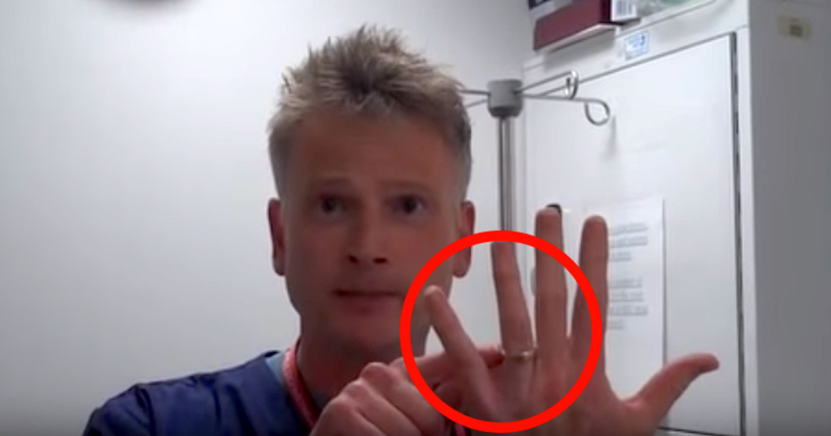Ring Stuck On Your Finger One Look At This Doctors Trick And Youll Never Worry Again