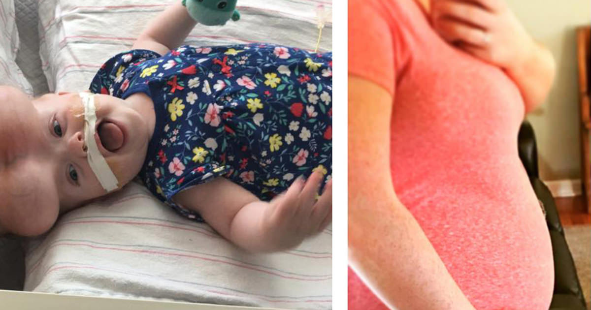 pregnant mom gets ultrasound, finds out baby has no brain. then, doctor gives her 2 options pregnant mom gets ultrasound, finds out baby has no brain. then, doctor gives her 2 options