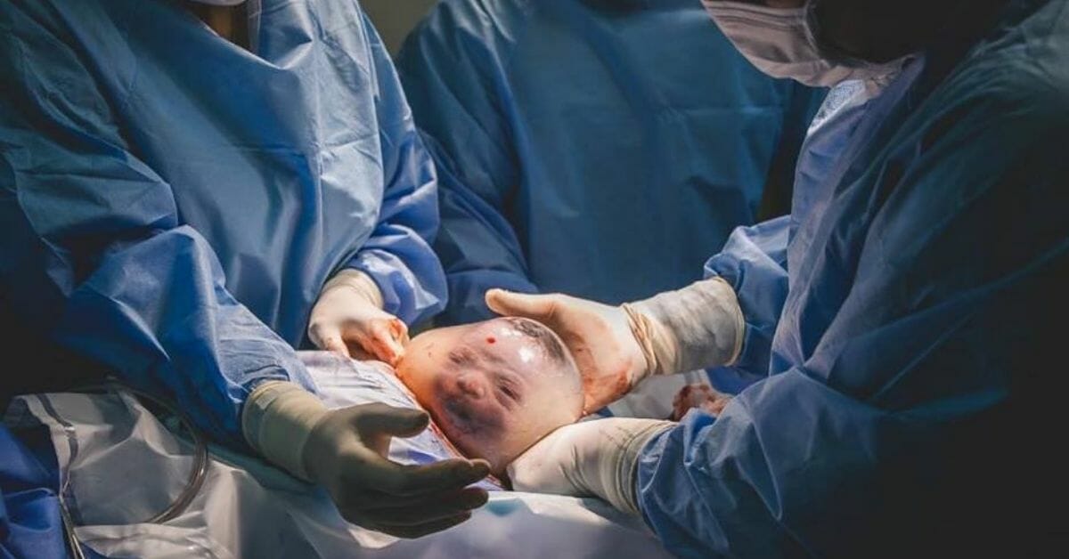 Breathtaking photos show baby being born still in his sac