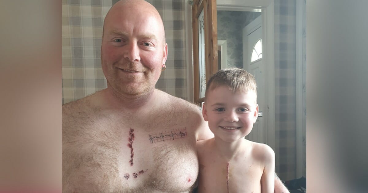 Dad gets tattoo to match 6-year-old son's open-heart surgery scar