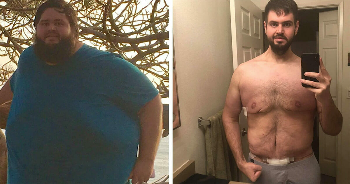 Engagement prompts groom-to-be to lose over 300 pounds.