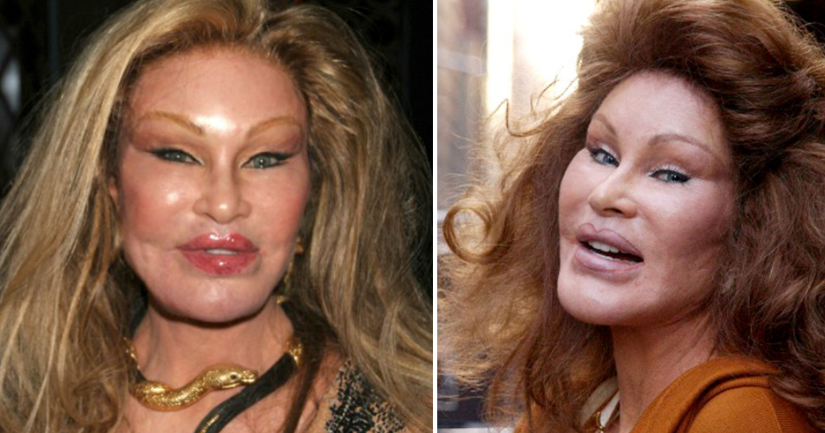 Inside The Life Of ‘Catwoman’ Jocelyn Wildenstein, The Billionaire ...