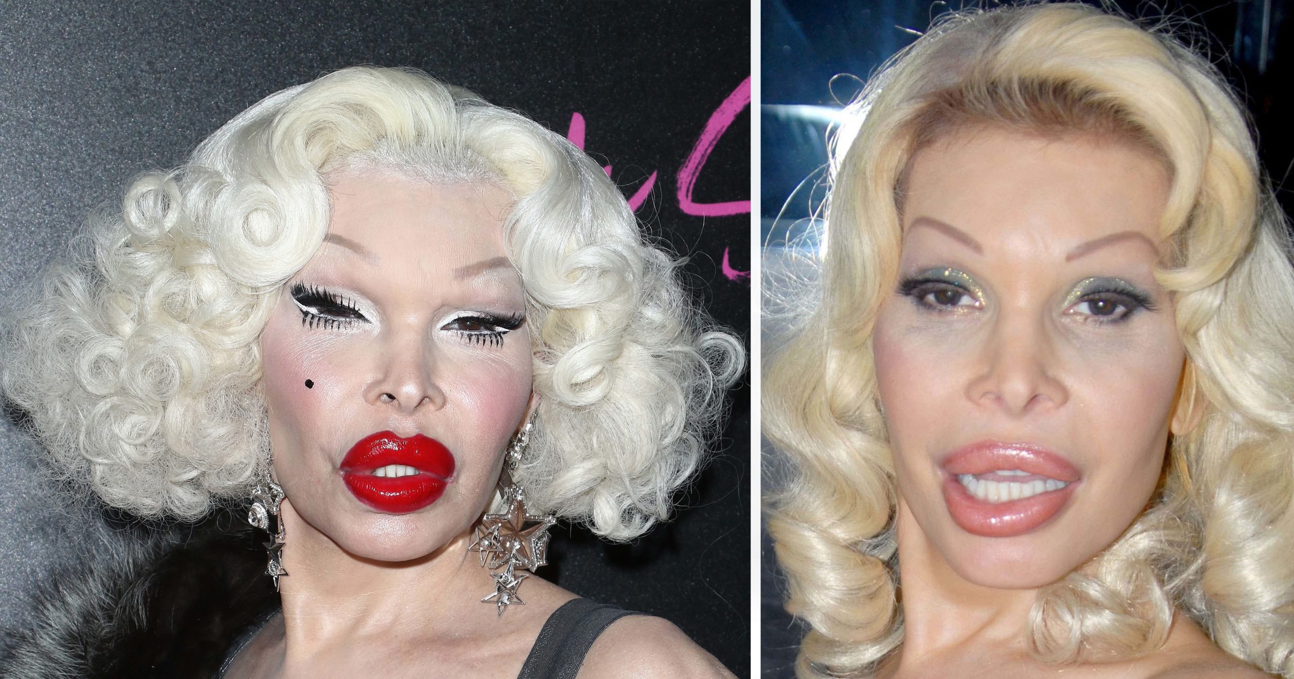 Amanda Lepore, "the most expensive body on earth": Pictur...