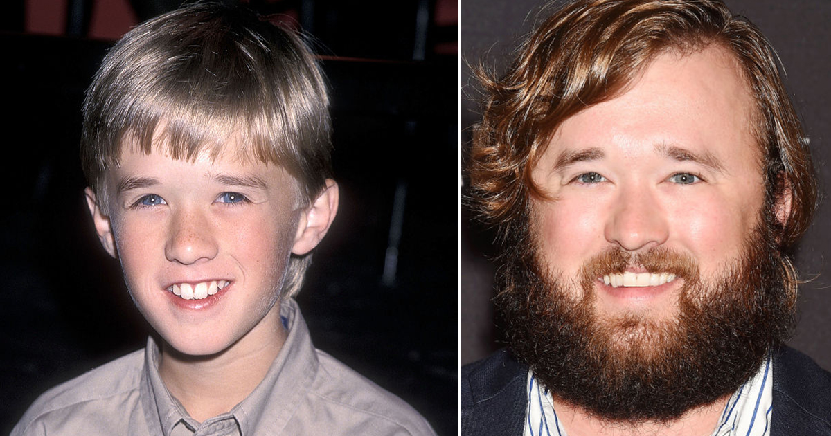 Haley Joel Osment today: Weight, net worth, family