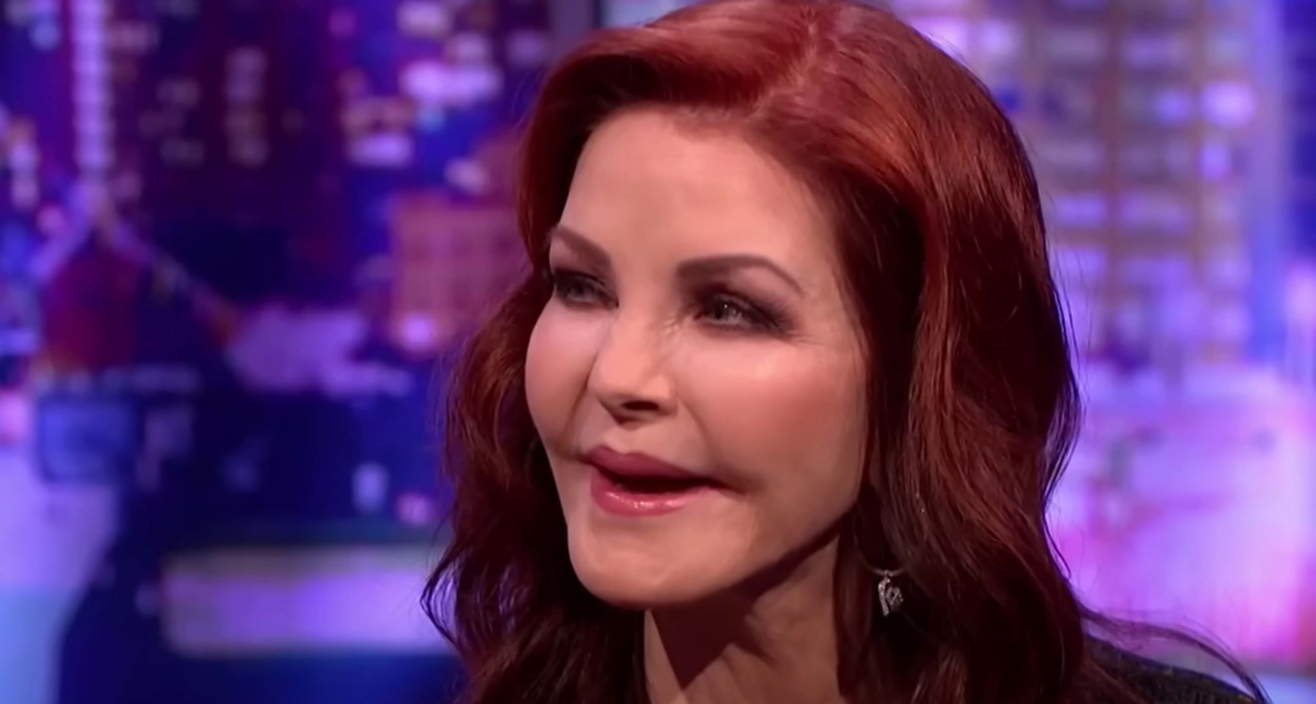 How Priscilla Presley, 77, had plastic surgery procedure gone wrong