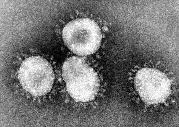 coronavirus, lungvirus