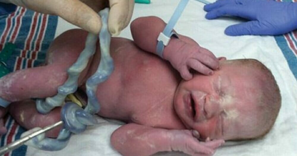 A child whose umbilical cord was photographed by his father