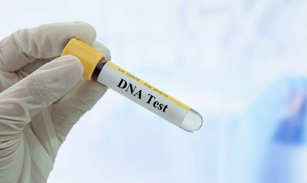 fiolka z testem DNA