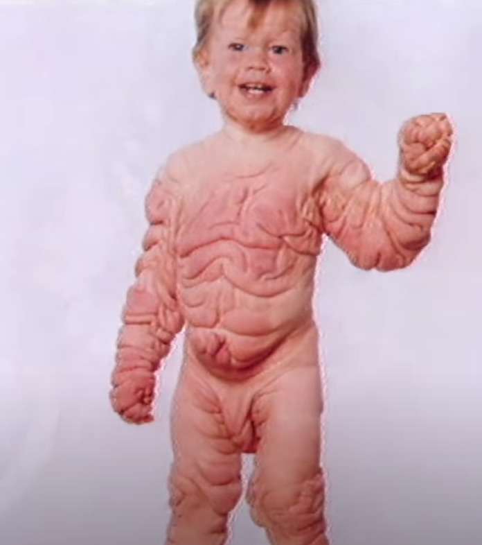 dziecko z chorobą skóry