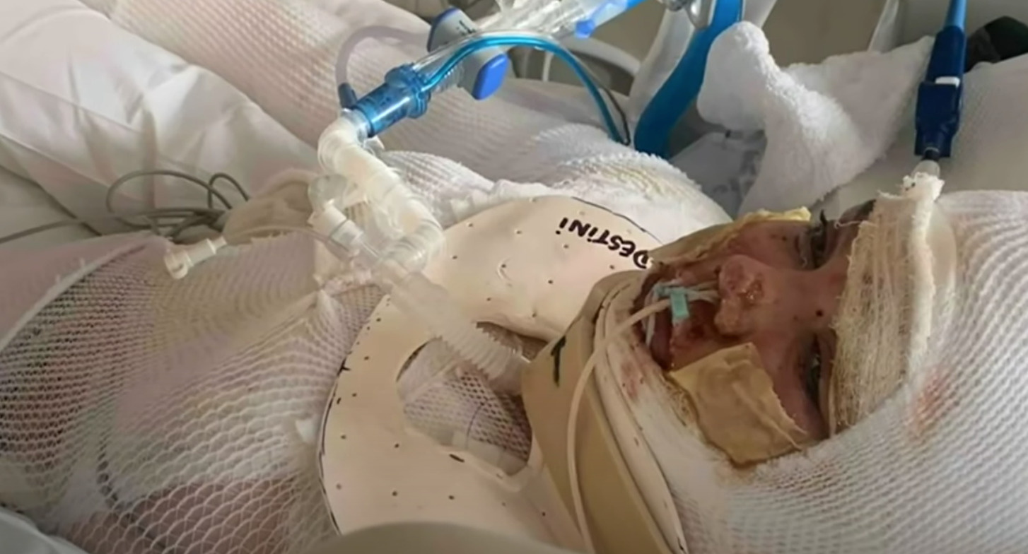 osoba w ciężkim stanie w szpitalu