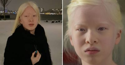 Dziewczyna została porzucona przez rodziców z powodu albinizmu - teraz została fotomodelką