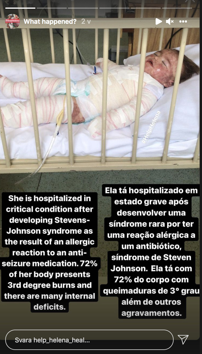 dziecko leży zawinięte w bandaże