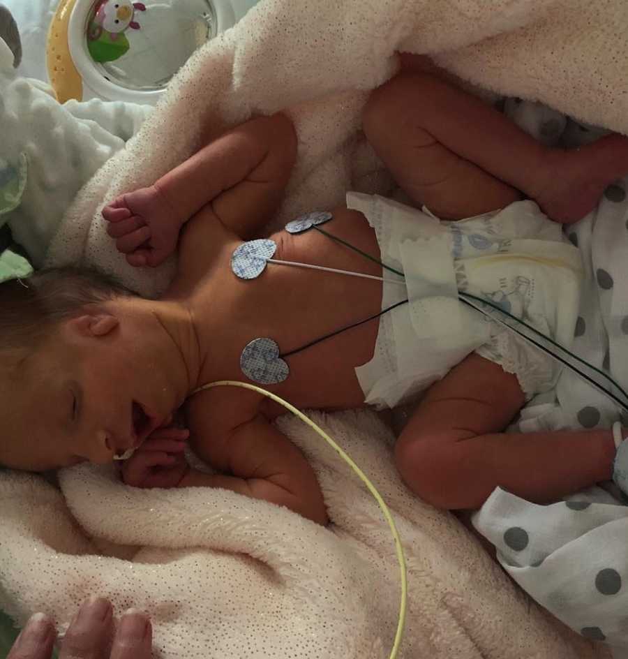noworodek podłączony do aparatury medycznej