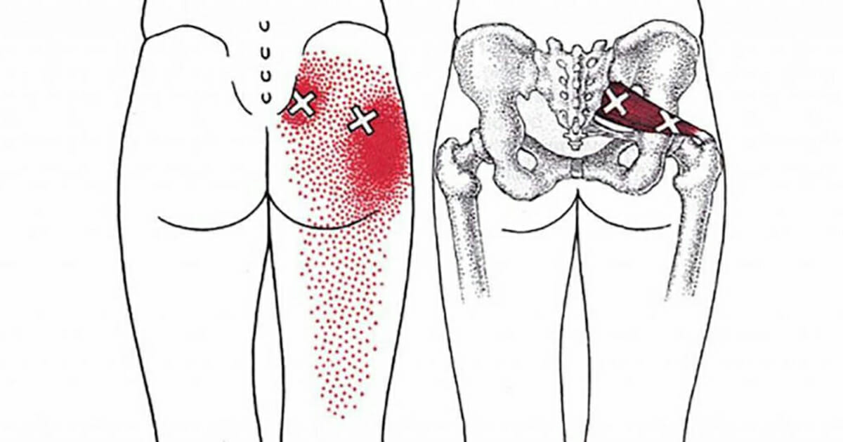 Sådan lindrer ryg- og nervesmerter på ingen – med disse 7 strækøvelser