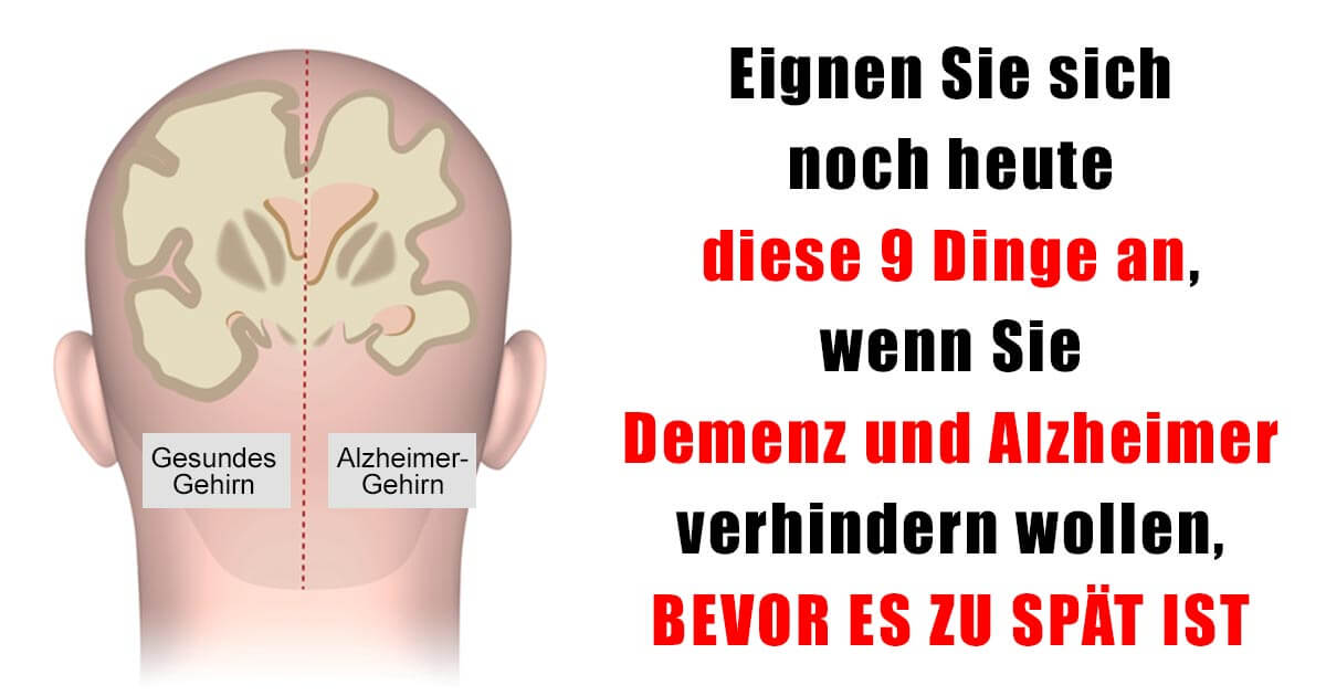 Eignen Sie Sich Noch Heute Diese 9 Dinge An Wenn Sie Demenz Und Alzheimer Verhindern Wollen Bevor Es Zu Spat Ist