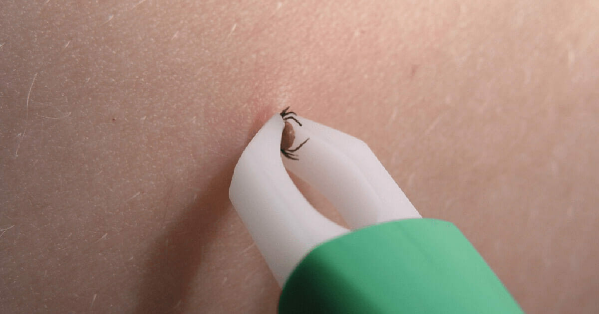 Ein einfacher Trick, den jeder wissen sollte: Dies sollte getan werden ...