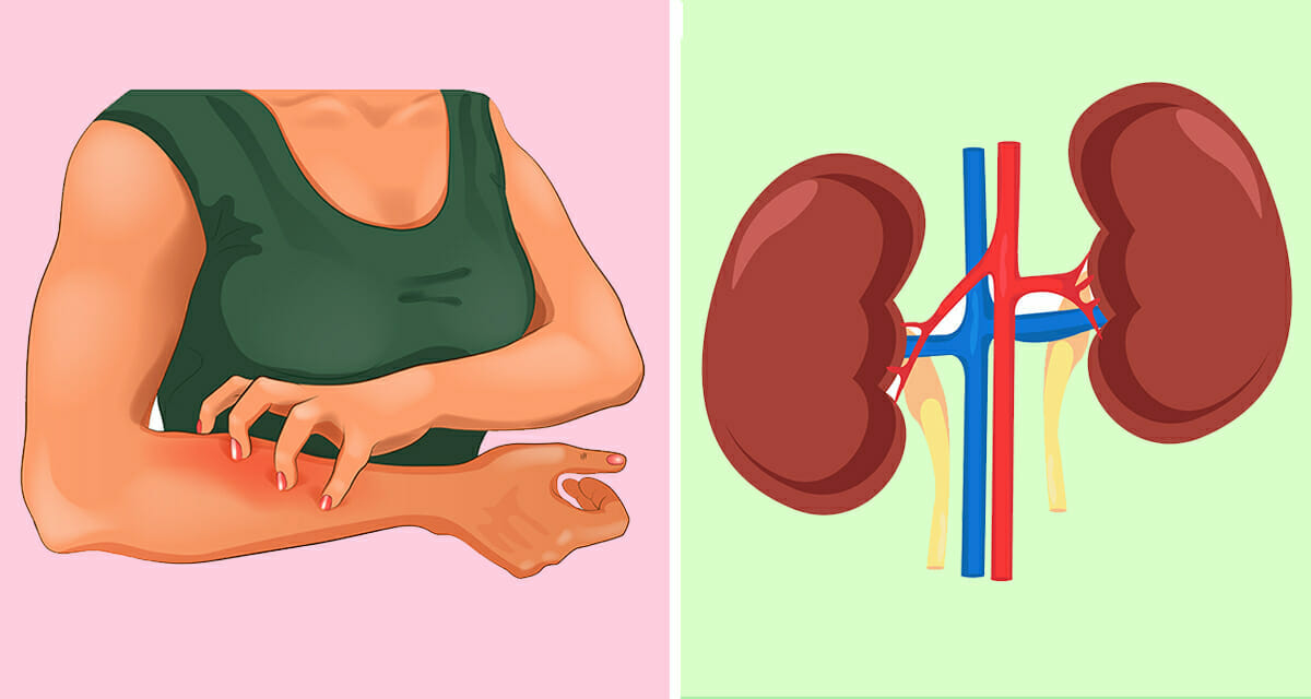 Dein Körper warnt dich 8 Anzeichen für eine mögliche Nierenkrankheit