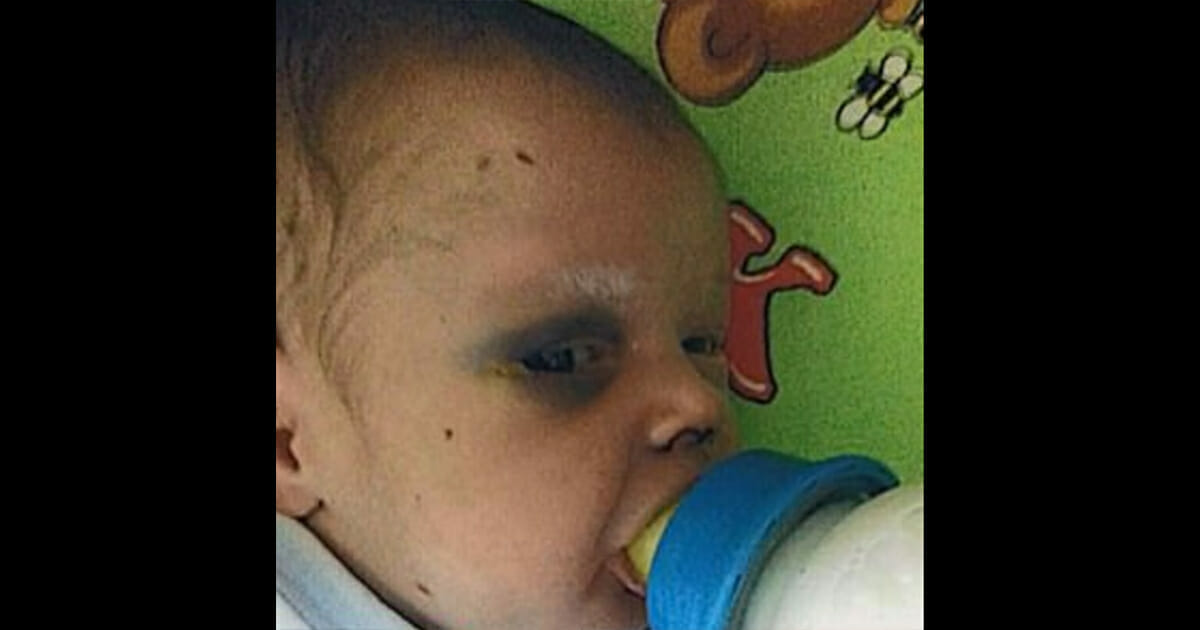 Baby Kampft Um Sein Leben Nachdem Mutter Es Verprugelte Um Zu Daten