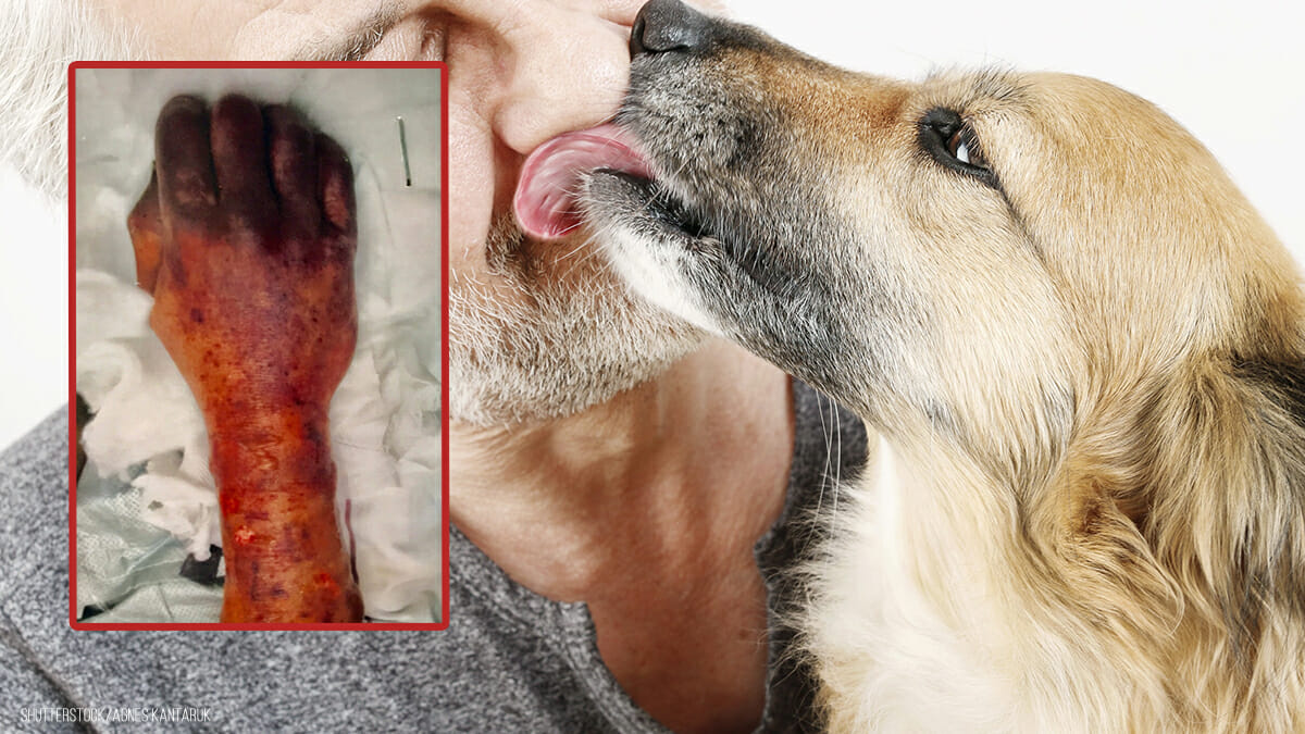 Hund leckt Herrchen durchs Gesicht 63Jähriger stirbt an Infektion