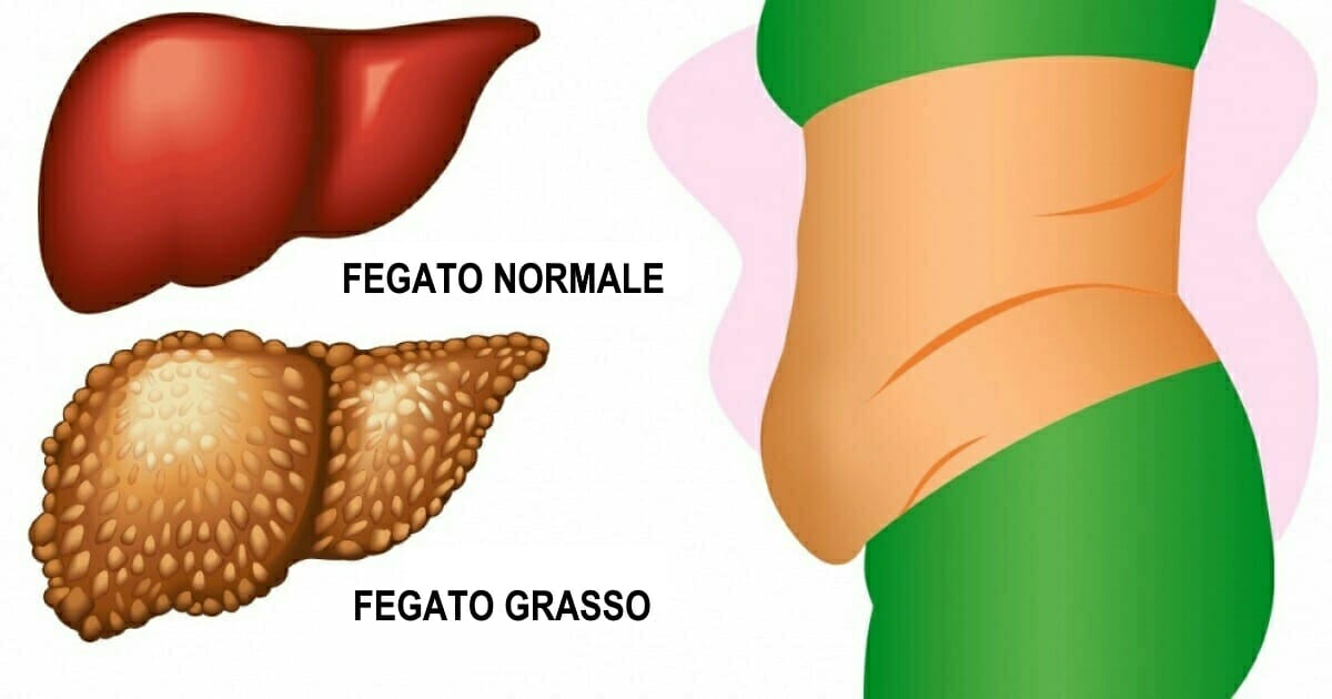 6 Segnali Che Il Tuo Fegato è Pieno Di Tossine