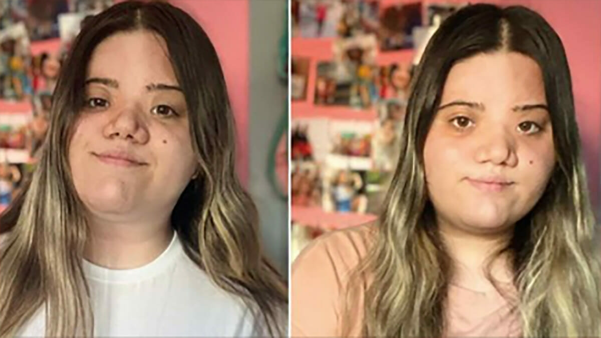 Ventenne Bullizzata Sui Social Per Il Suo Viso Fa Un Video Di Supporto 