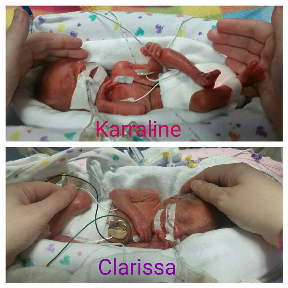 Они усыновили 2 пары близнецов от одной матери, а потом произошло настоящее чудо…