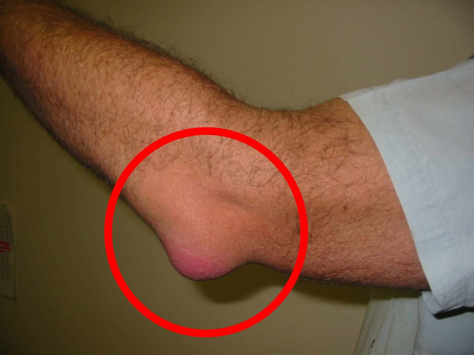 Gezwollen voeten: 9 alarmerende tekenen die je nooit mag negeren