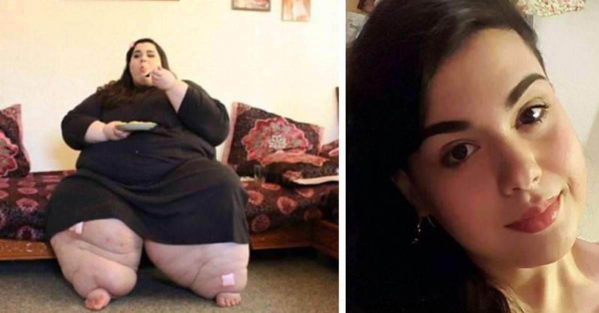  24 Ans Elle Pesait 300 Kilos Admirez Maintenant Son Incroyable 