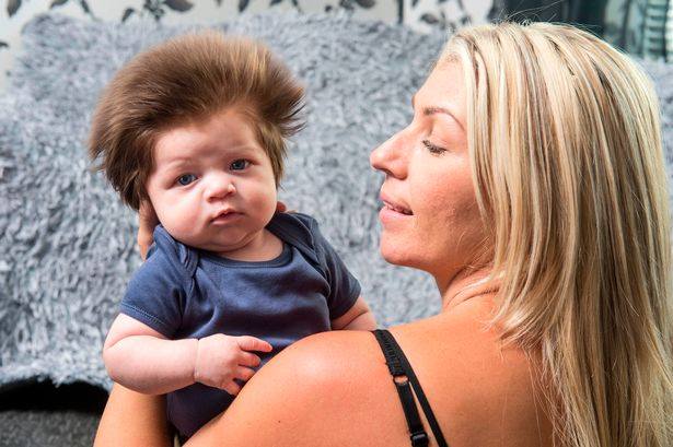 La Maman Donne Naissance A Un Bebe Aux Cheveux Extremement Longs Y Regarde De Plus Pres Et Decouvre La Choquante Verite