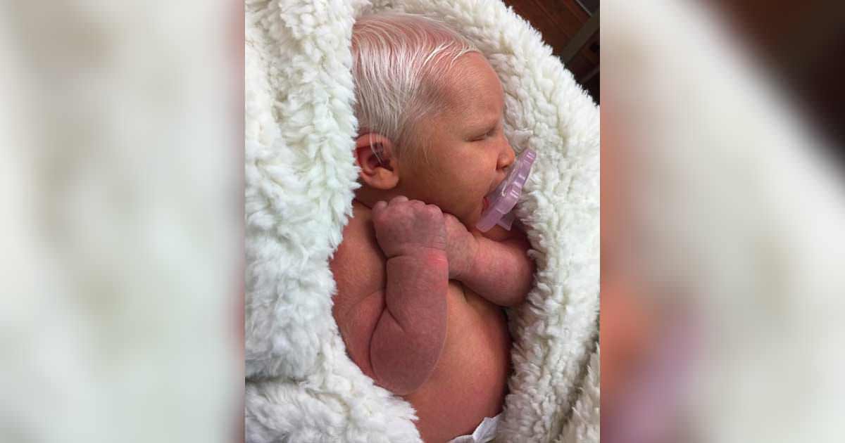 Ce Bebe Qui Ressemble A Une Poupee Est Ne A L Hopital Il Choque Tout Le Monde Avec Ses Cheveux Blancs
