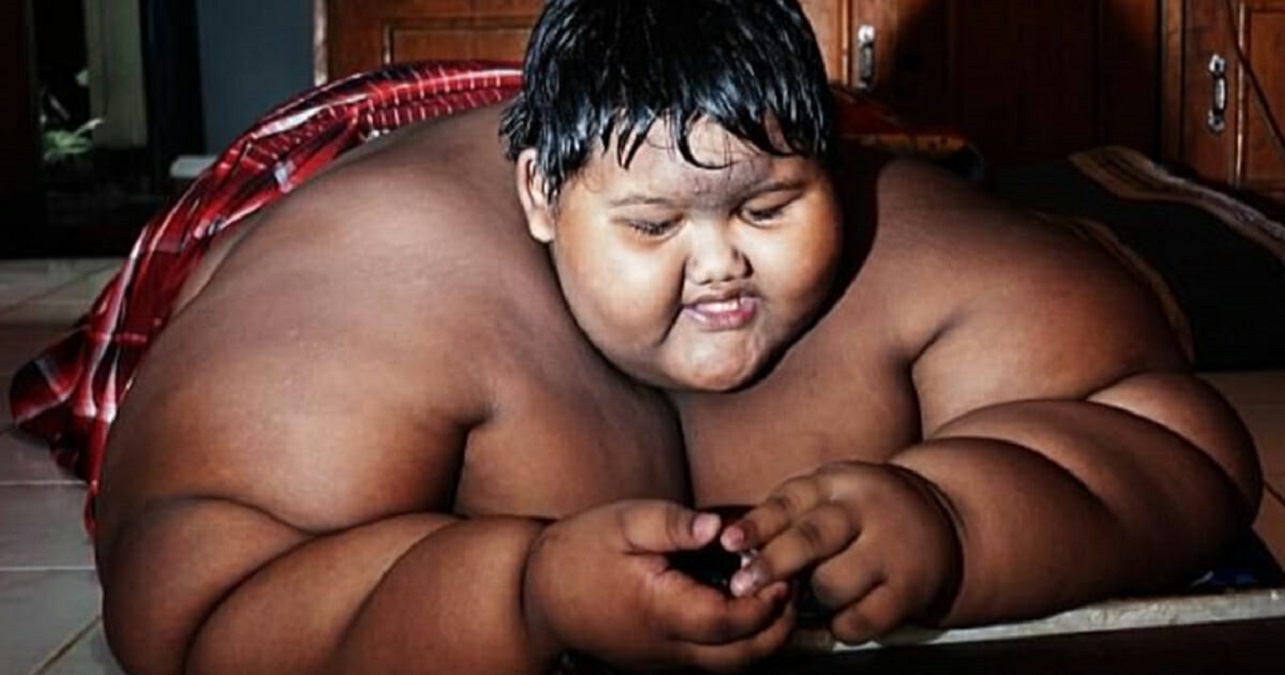 Le Garcon Le Plus Obese Du Monde Perd La Moitie De Son Poids Apres Une Operation Qui Lui Sauve La Vie