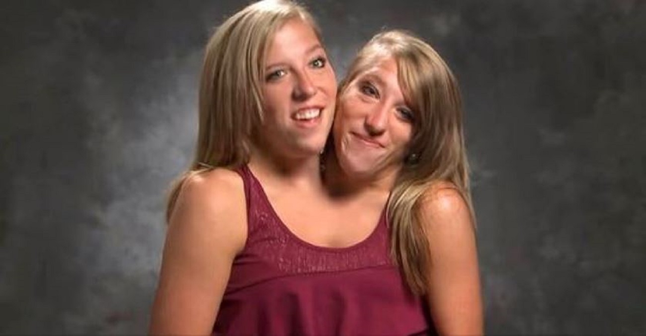 Les Soeur Siamoise Abby Et Brittany